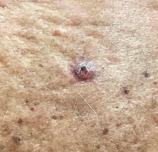 What to do when you discover a new “spot”