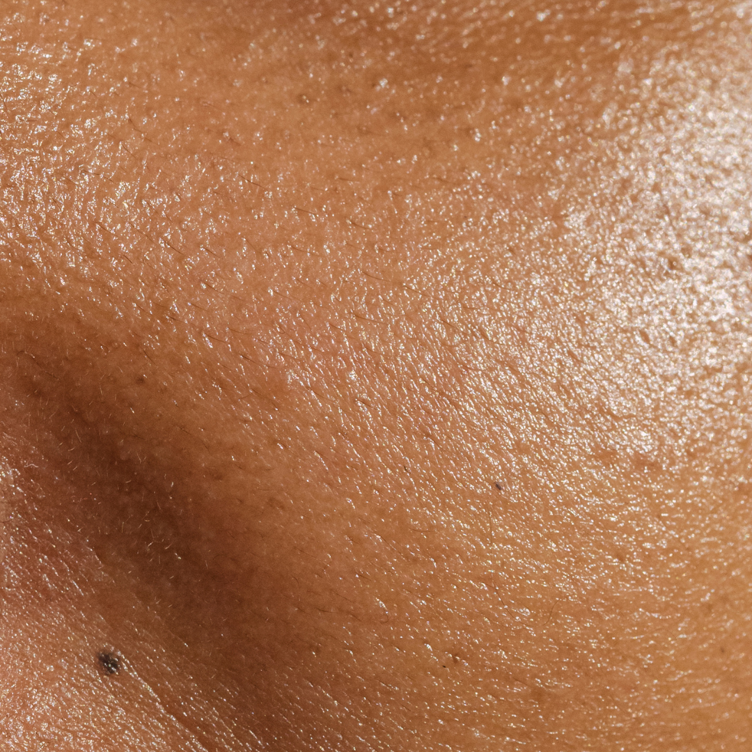 Facial Harmonization