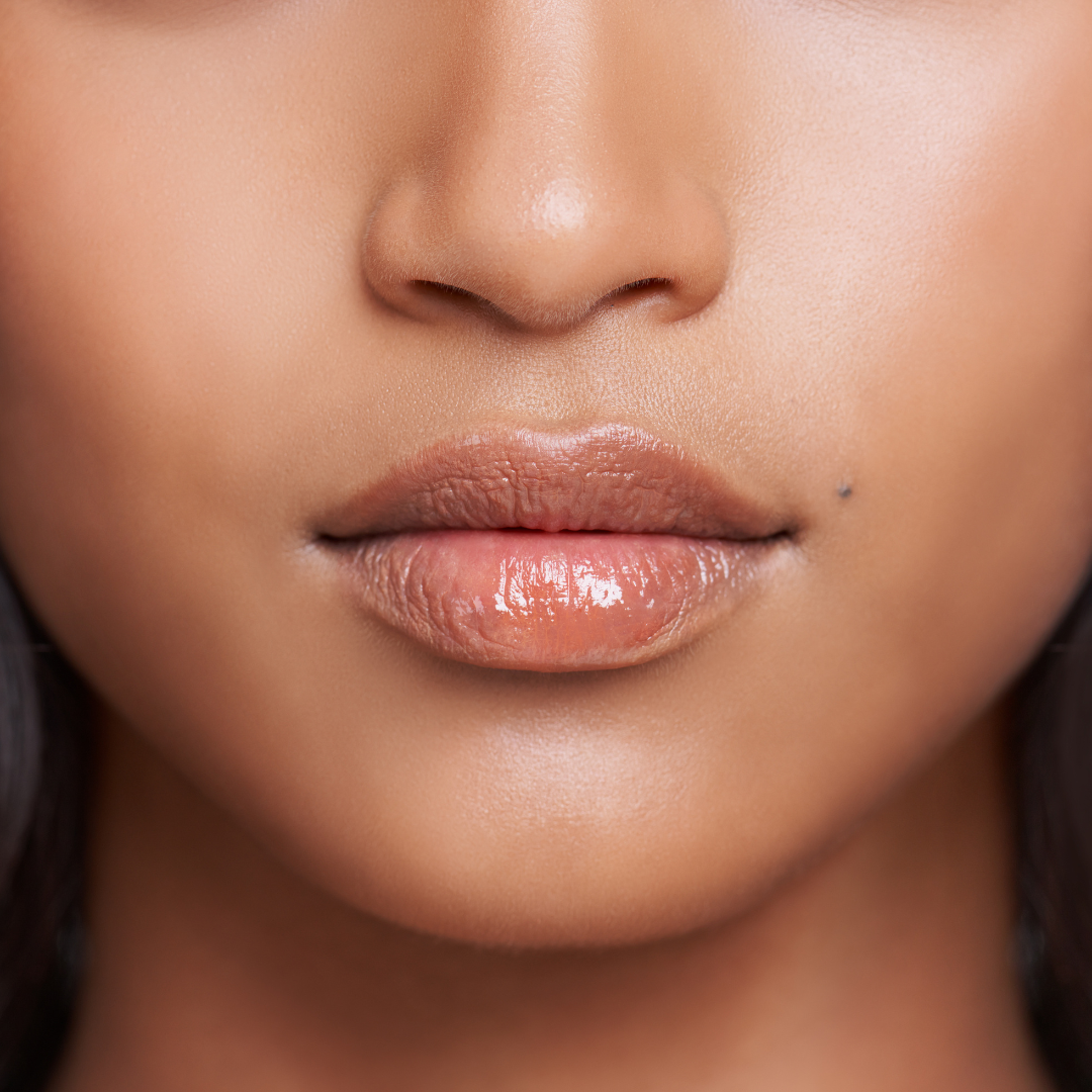 Lip Rejuvenation