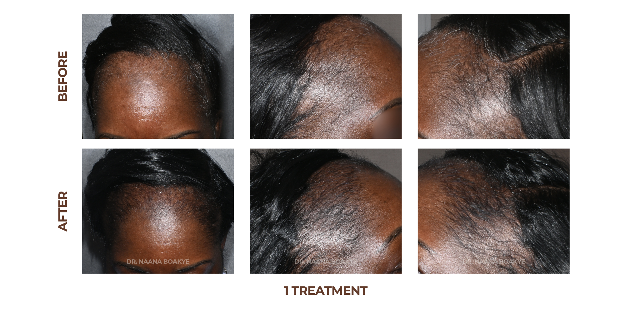 Scalp Health Restoration