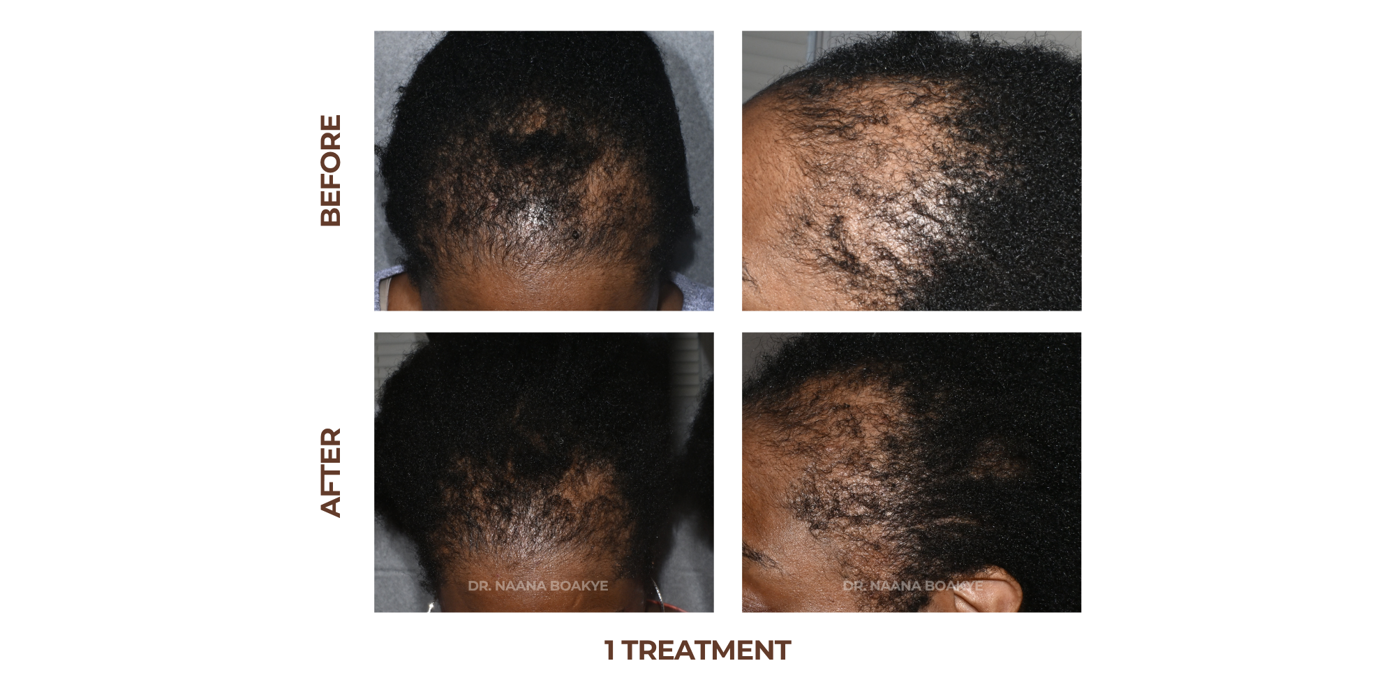 Scalp Health Restoration