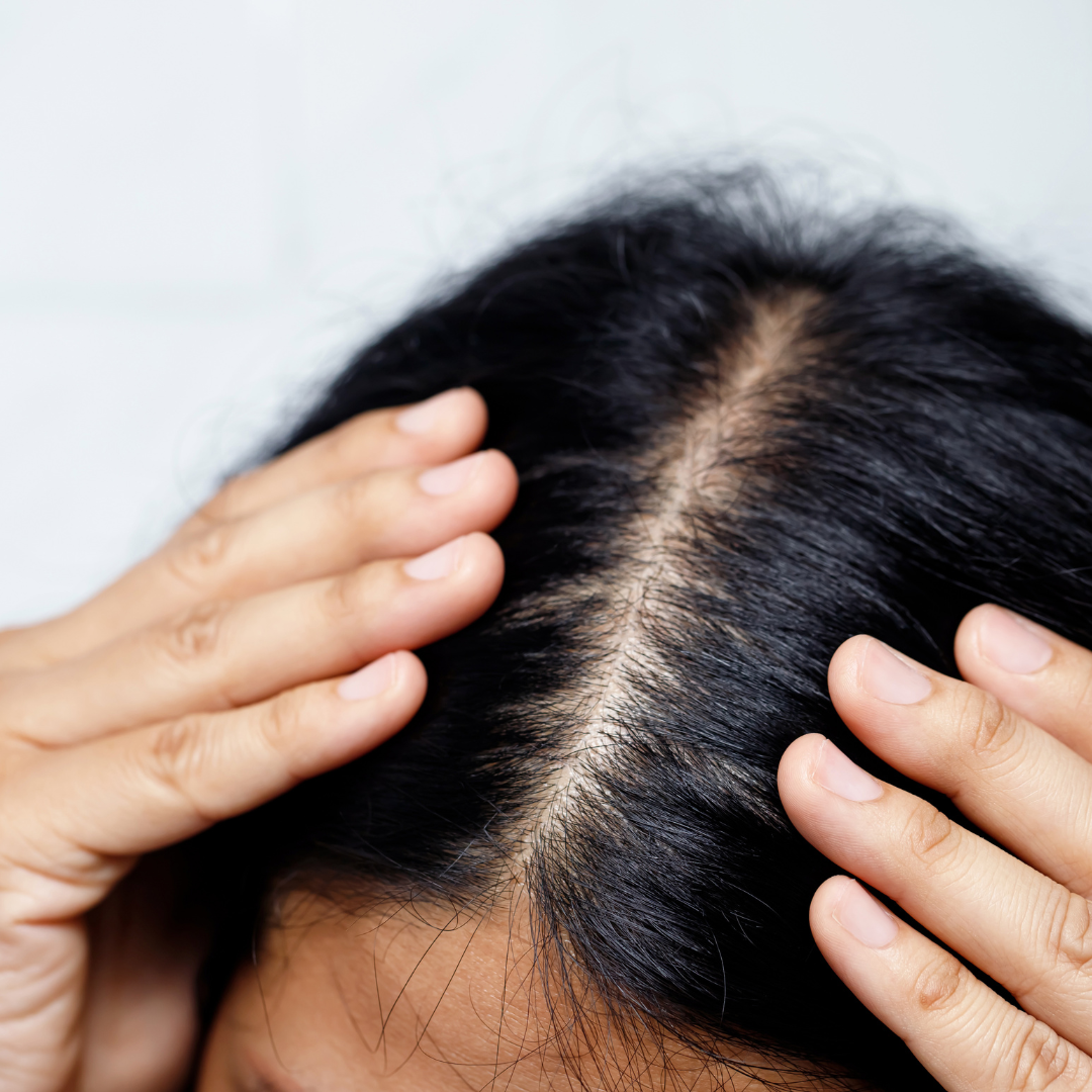 Scalp Health Restoration